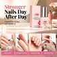 💅 50% RABATT 🌿 3-i-1 nagelstärkande behandling för skadade naglar💧