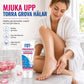 ✅50% RABATT🦶60ml Urea fotvårdsgel – exfolierar hud, återfuktar torra och spruckna fötter💧